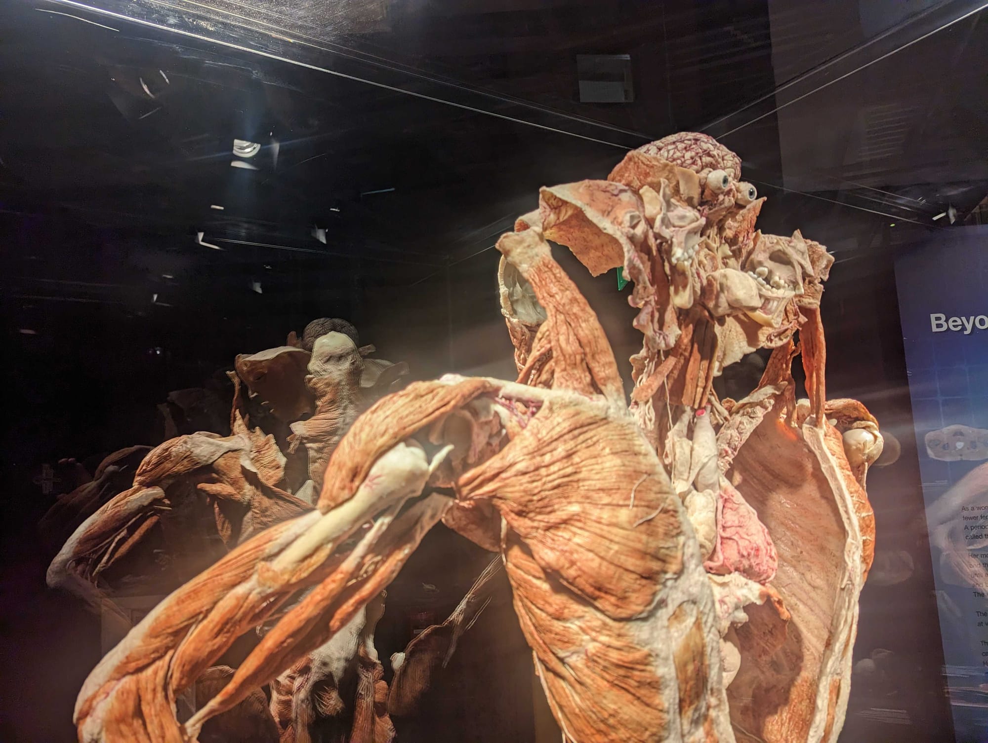 Whole-body plastinates and organs are displayed at the BODY WORLDS RX exhibition at Allentown's Da Vinci Science Center. The 