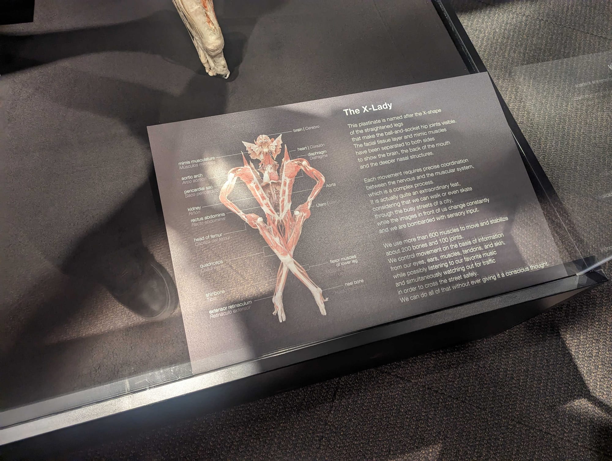 Whole-body plastinates and organs are displayed at the BODY WORLDS RX exhibition at Allentown's Da Vinci Science Center. The 