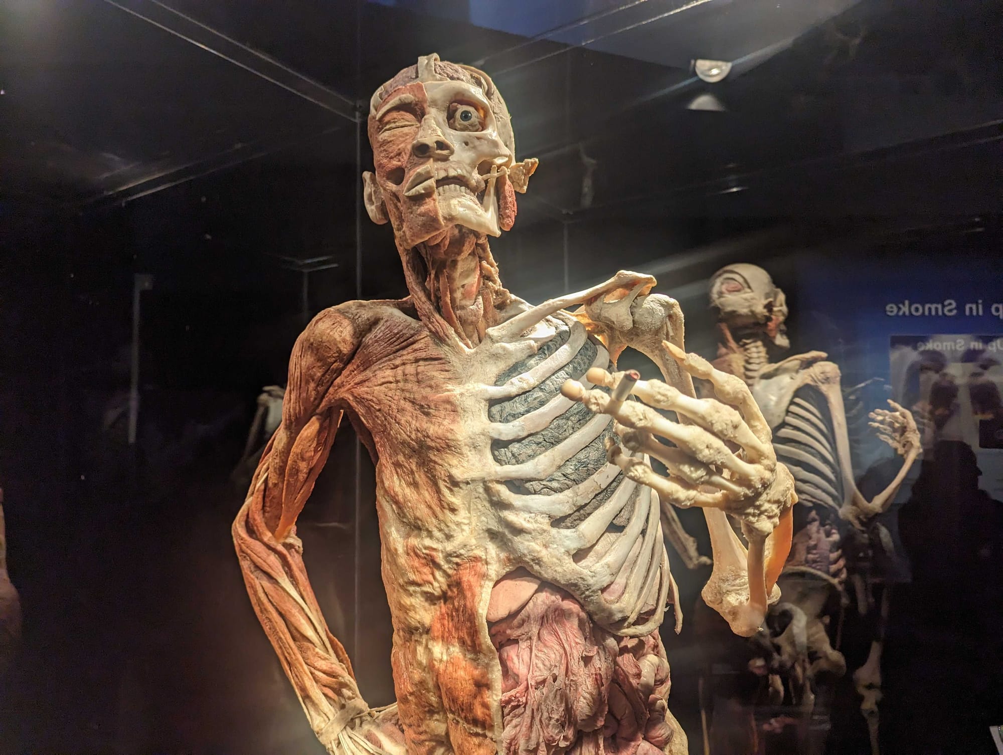 Whole-body plastinates and organs are displayed at the BODY WORLDS RX exhibition at Allentown's Da Vinci Science Center. The 