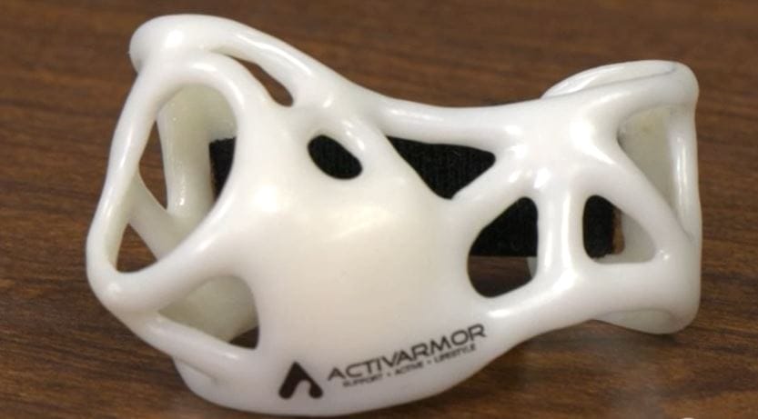 3D printed cast are now being made at St. Luke's University Health Network.