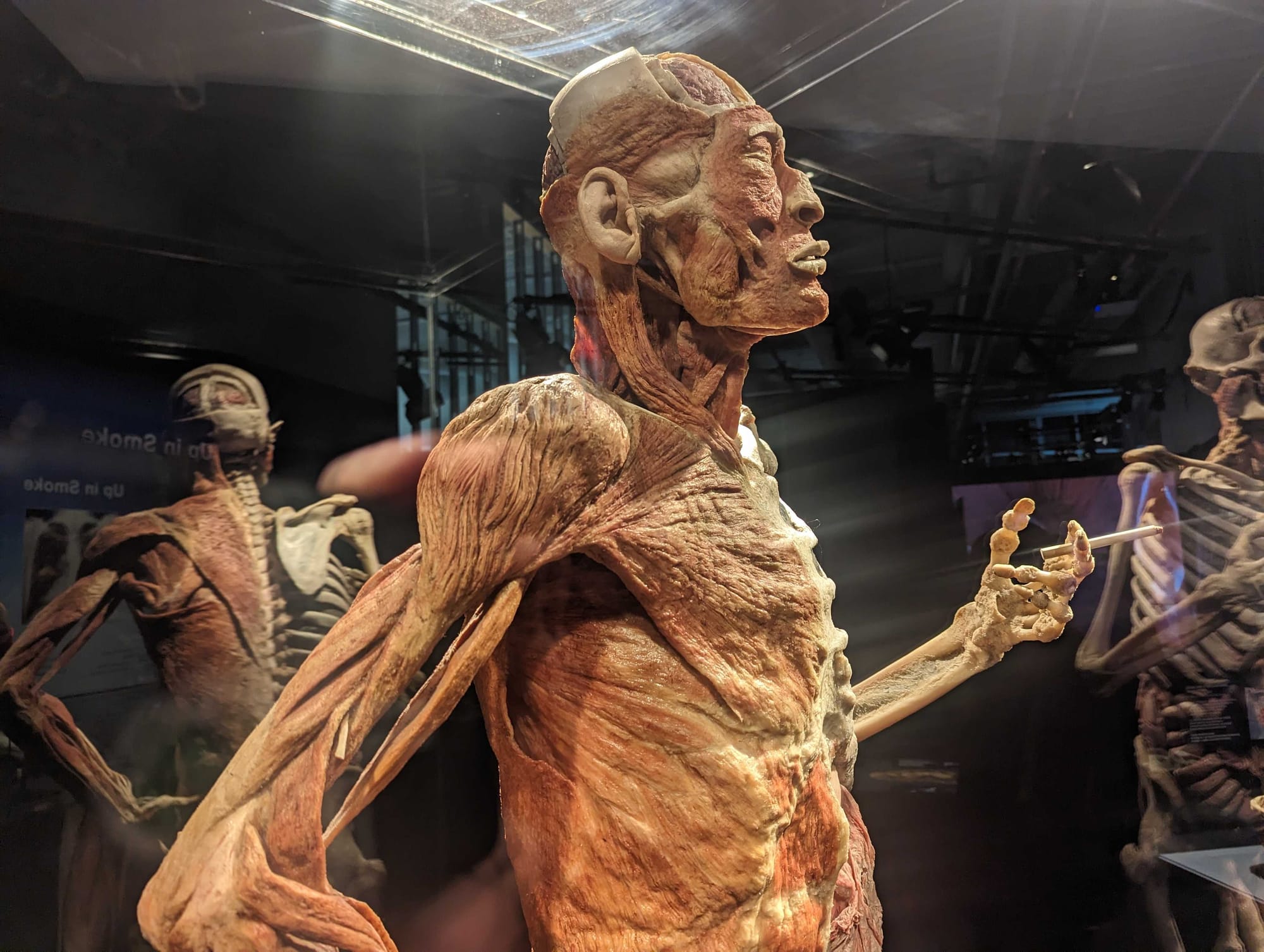 Whole-body plastinates and organs are displayed at the BODY WORLDS RX exhibition at Allentown's Da Vinci Science Center. The 