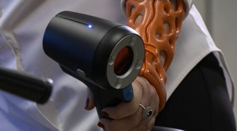 3D printed cast are now being made at St. Luke's University Health Network.
