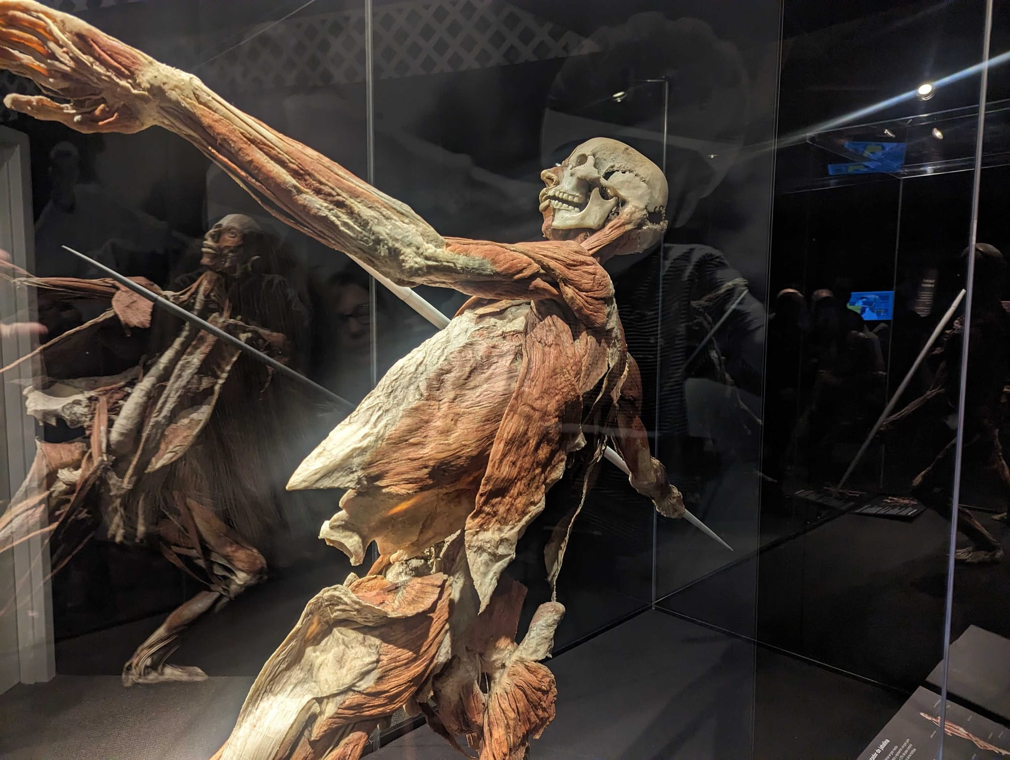 Whole-body plastinates and organs are displayed at the BODY WORLDS RX exhibition at Allentown's Da Vinci Science Center. The 