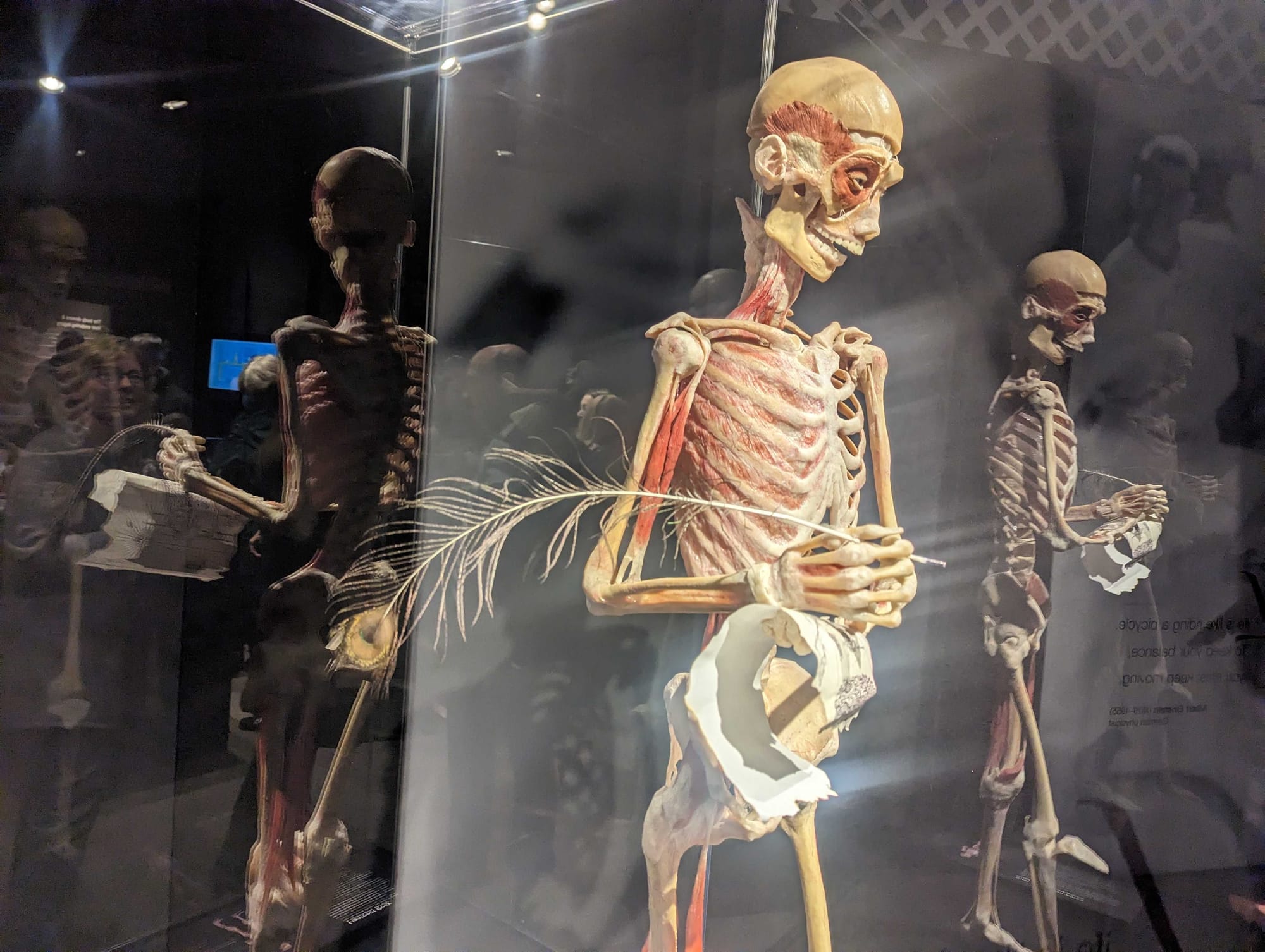 Whole-body plastinates and organs are displayed at the BODY WORLDS RX exhibition at Allentown's Da Vinci Science Center. The 