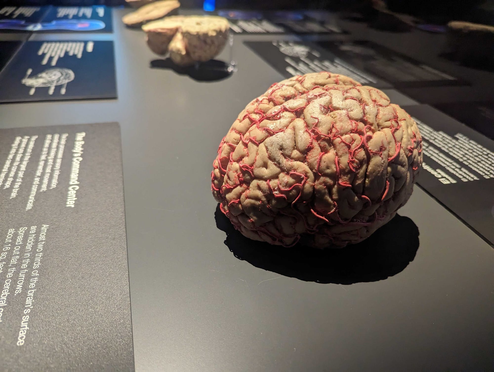 Whole-body plastinates and organs are displayed at the BODY WORLDS RX exhibition at Allentown's Da Vinci Science Center. The 