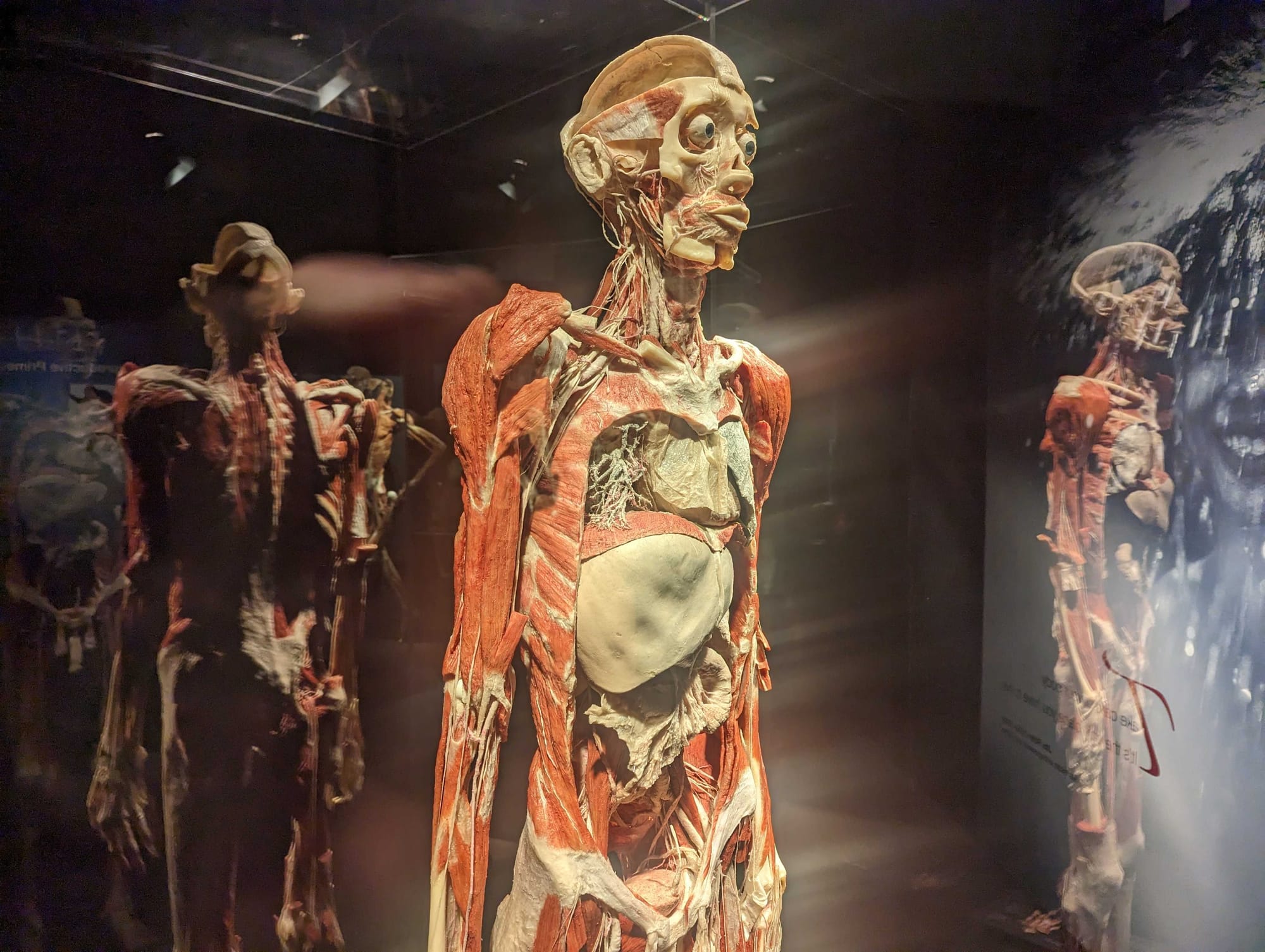 BodyWorlds1.jpg